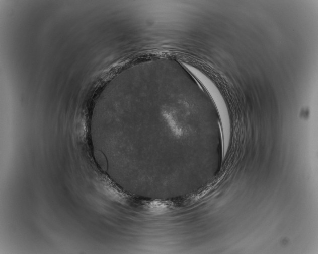 X0000100370566200806131040