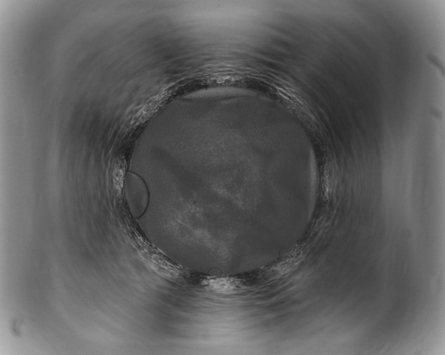 X0000100370417200806201632