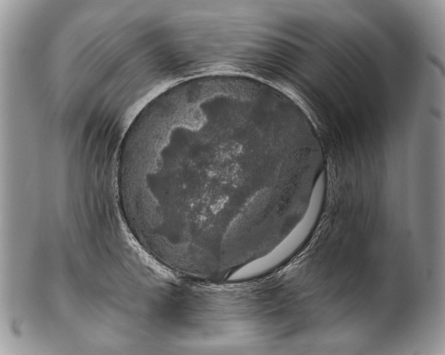 X0000100371142200806201621