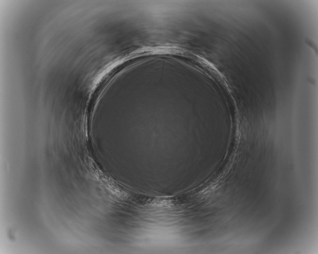 X0000100371174200806201620