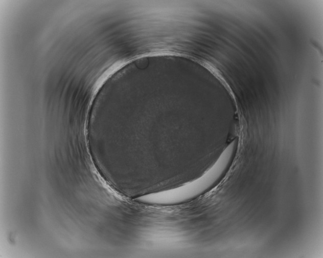 X0000100371197200806201620