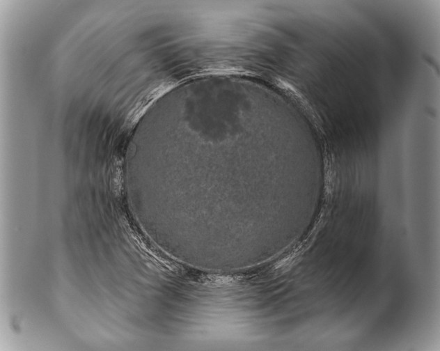 X0000100371361200806201618