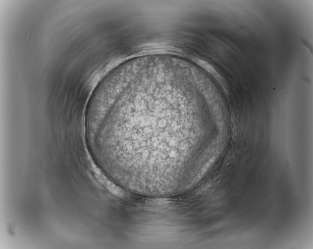 X0000100371431200806201617