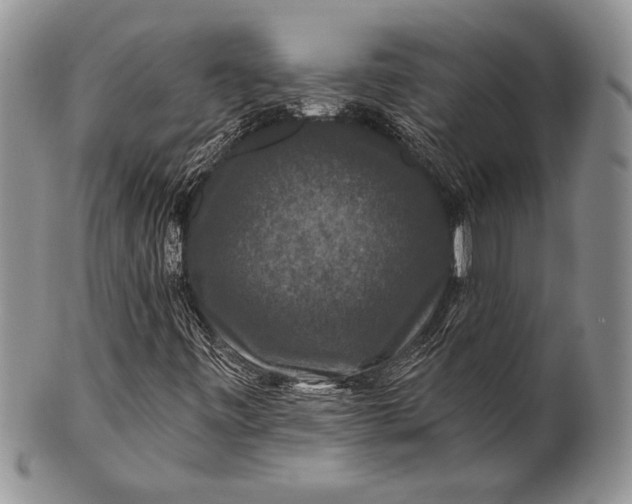 X0000100371443200806201617