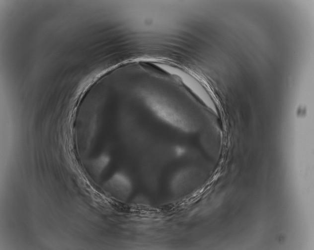X0000100380337200806131104