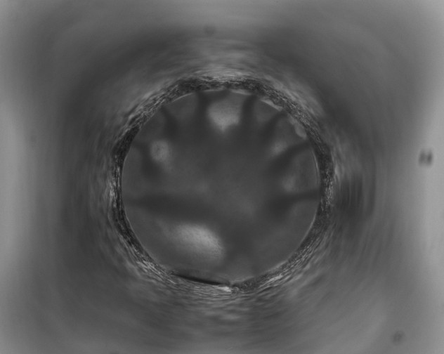 X0000100381397200806131049