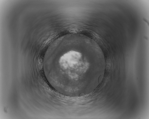 X0000100380043200806201701