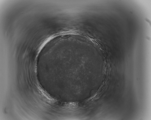 X0000100380056200806201700