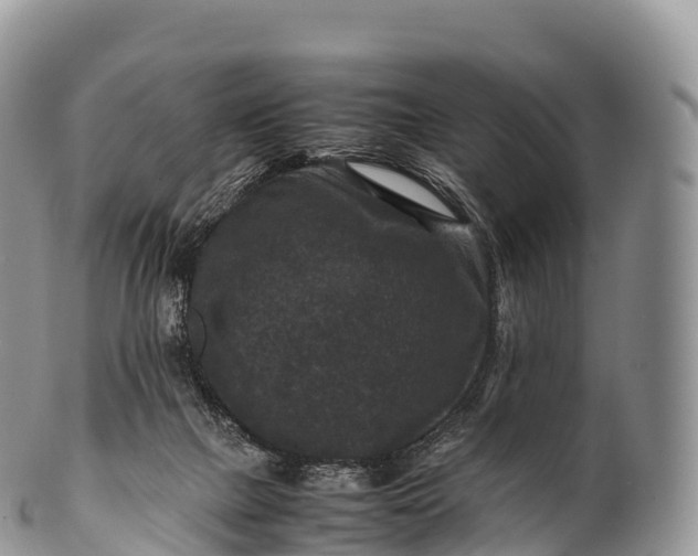 X0000100380073200806201700