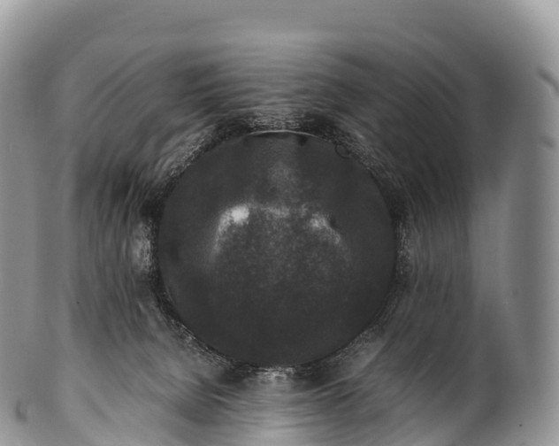 X0000100380080200806201700