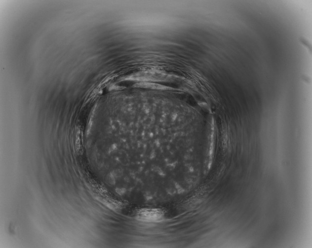 X0000100380169200806201659