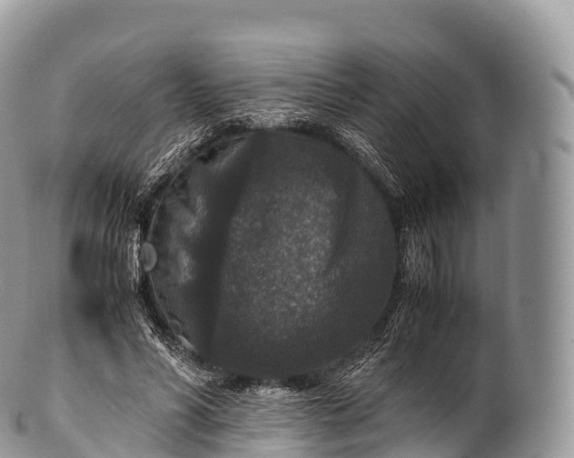 X0000100380590200806201652