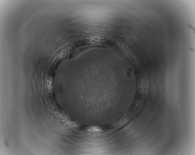 X0000100380610200806201652