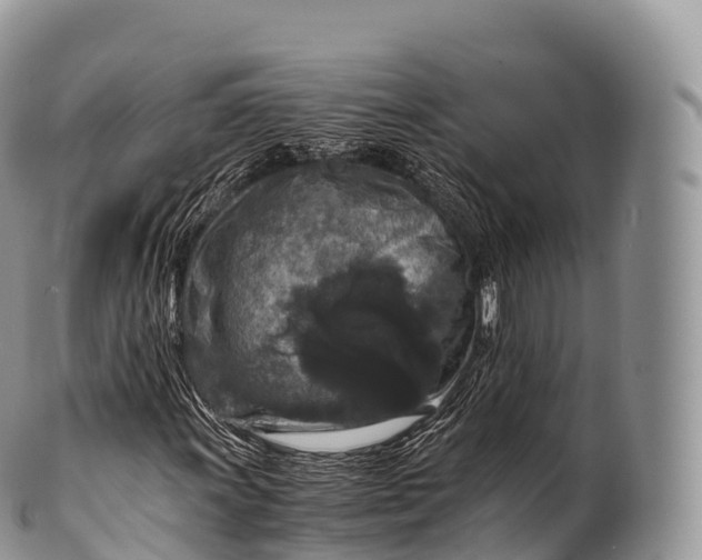 X0000100381011200806201645