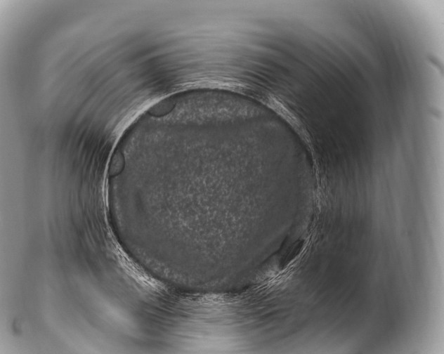 X0000100381028200806201645