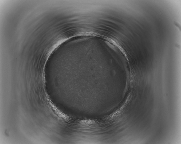 X0000100381037200806201646