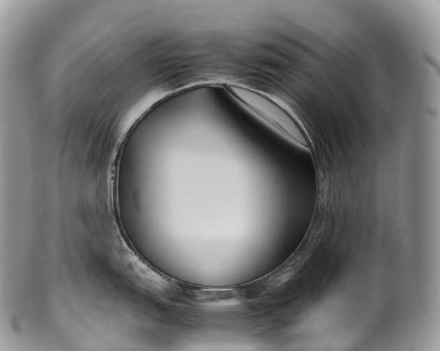 X0000100381151200806201644