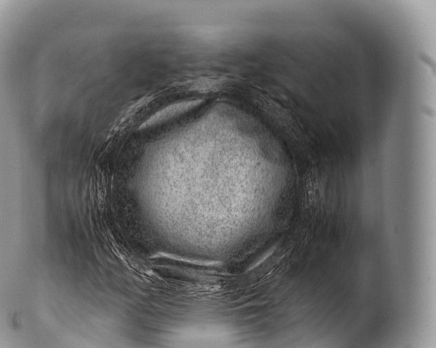 X0000100381158200806201644