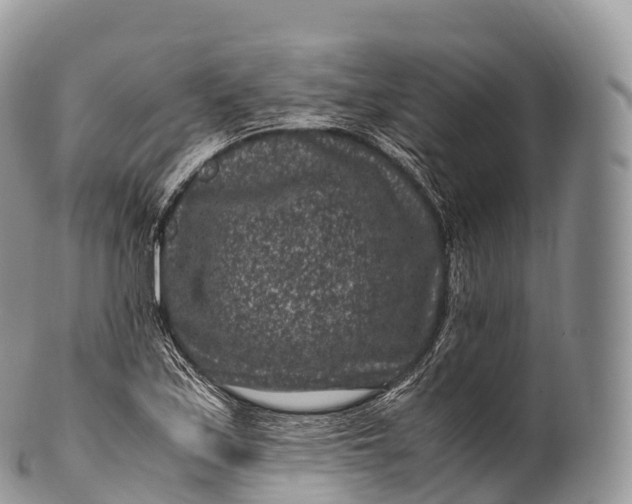X0000100381171200806201644
