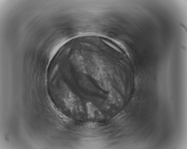 X0000100381279200806201642