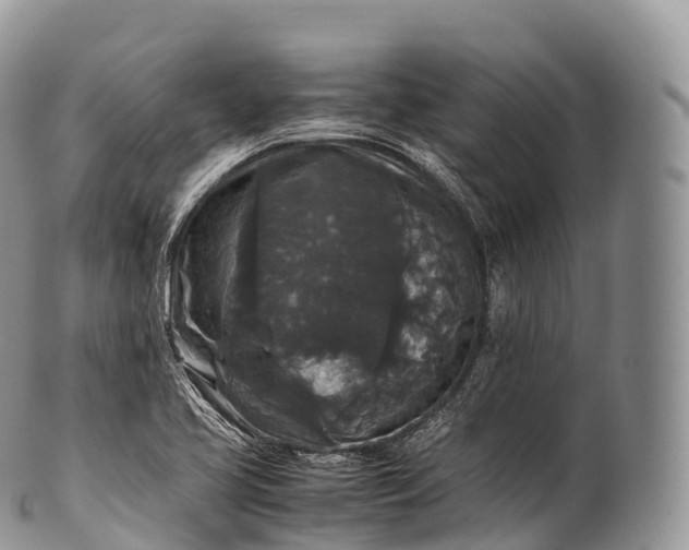 X0000100381413200806201640