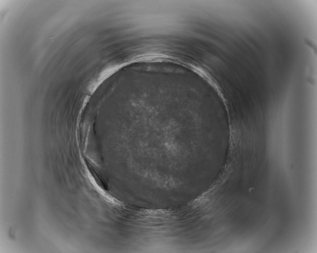 X0000100381429200806201640