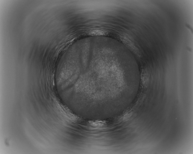 X0000100380359200806271339