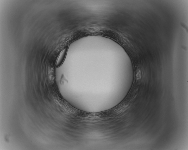 X0000100381156200806271327