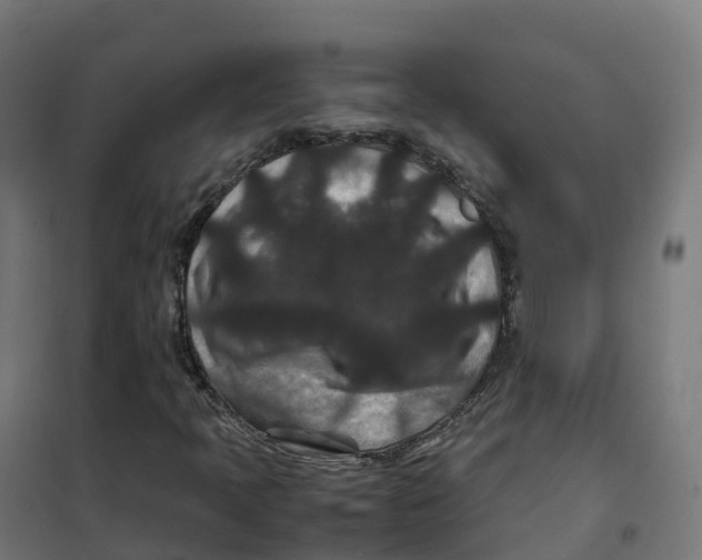 X0000100381397200807031914