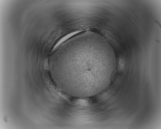 X0000100390236200806130959