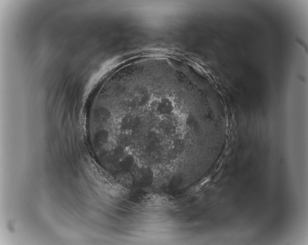 X0000100390343200806130957