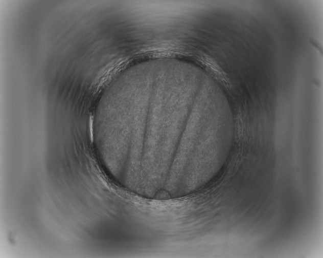 X0000100390022200806201724