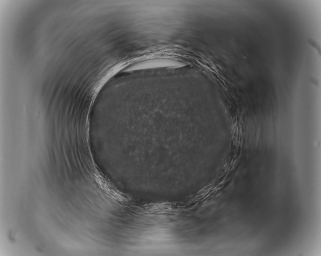 X0000100390100200806201723