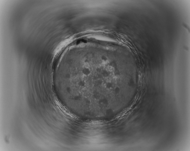 X0000100390149200806201721