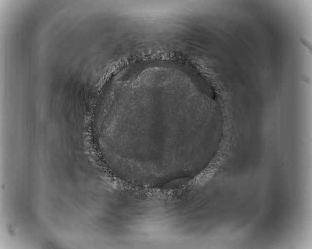 X0000100390192200806201722