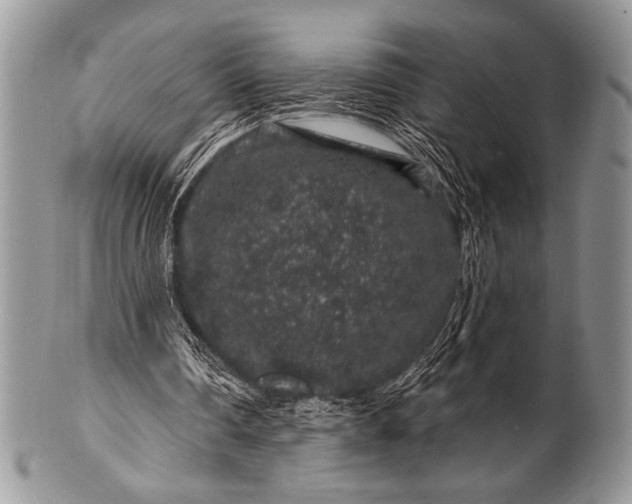 X0000100390290200806201720