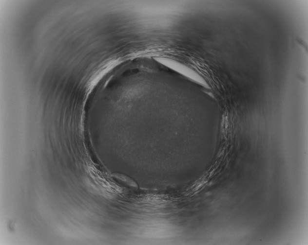 X0000100390292200806201720