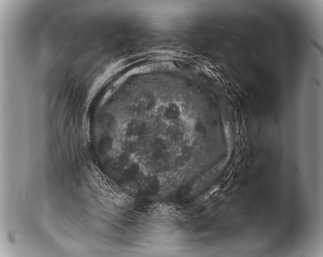 X0000100390343200806201719