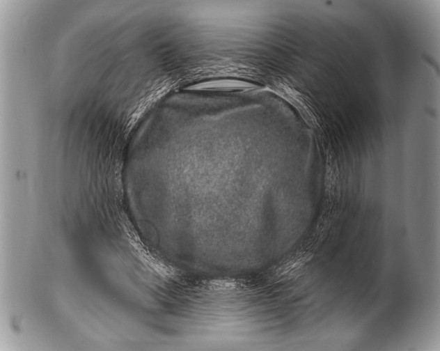 X0000100390394200806201718