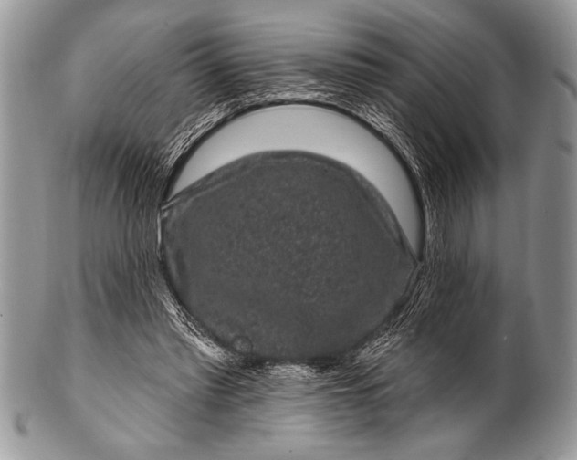 X0000100390397200806201718