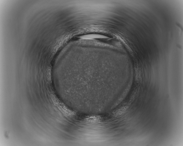 X0000100390447200806201717