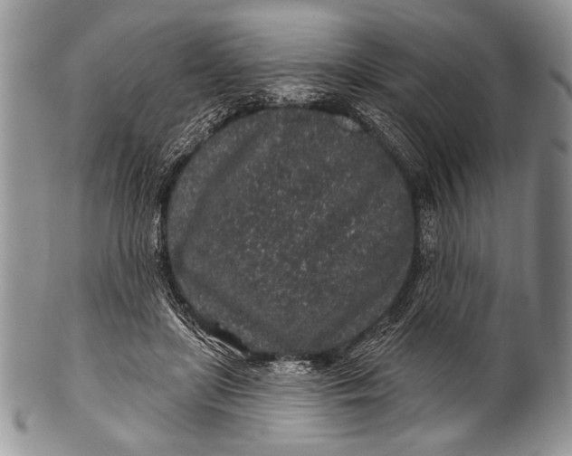 X0000100390451200806201717