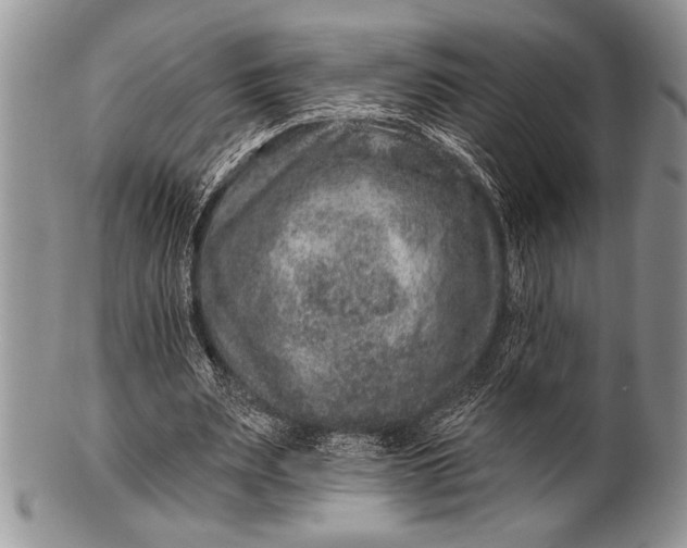 X0000100390487200806201717