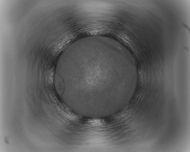 X0000100390499200806201717