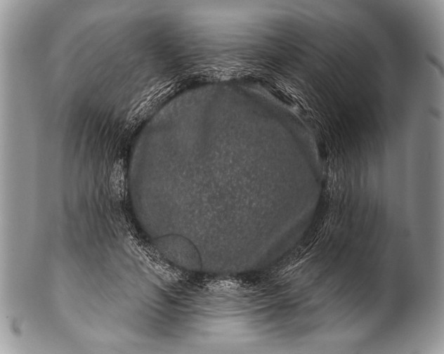 X0000100390594200806201715