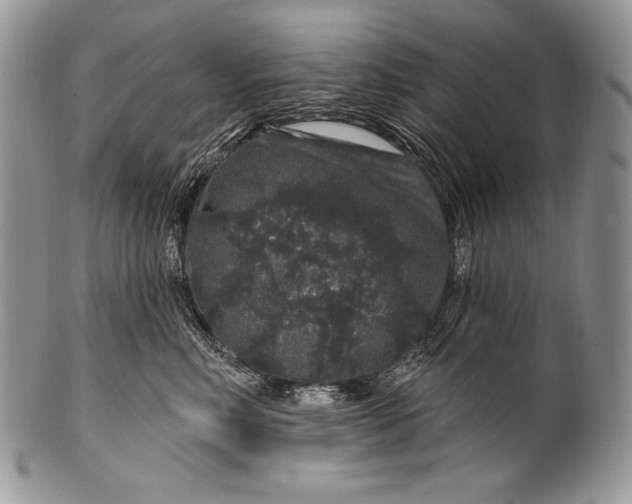 X0000100390618200806201715