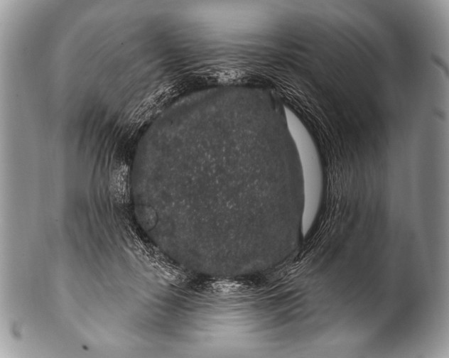 X0000100390650200806201715