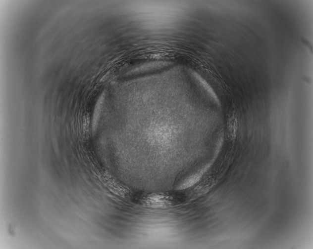 X0000100390657200806201715