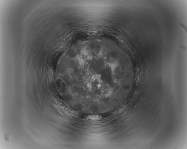 X0000100390659200806201715