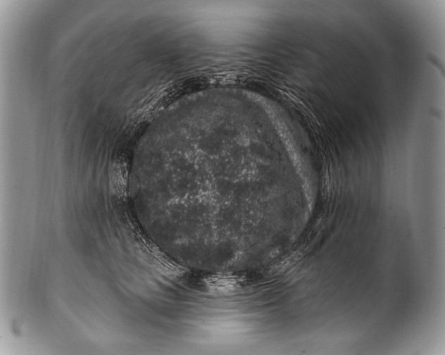 X0000100390661200806201715